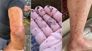 O fim da picada: prefeitura culpa ocupação do solo que ela não fiscaliza por infestação de borrachudos