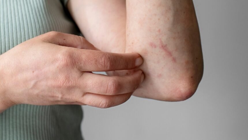 Fim da picada! Vereadores cobram de Eduardo Paes solução para infestação de mosquitos borrachudos