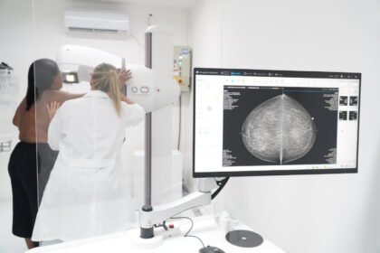 Mais acesso à prevenção: Mutondo passa a oferecer mamografia em São Gonçalo