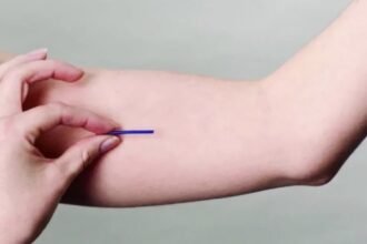 Araruama oferece contraceptivo de alta eficácia pelo SUS e garante autonomia às mulheres