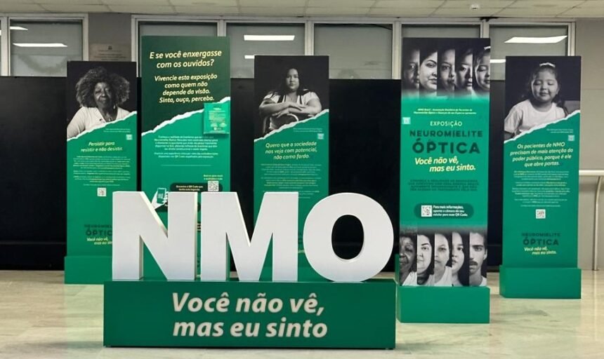 Palácio Tiradentes abre portas para exposição sobre doença rara