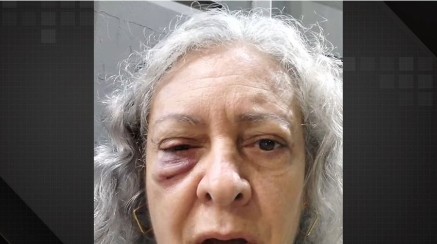 Idosa agredida por cantar louvor cobra deis mais duras e dispara: 'Não dá em nada'