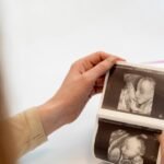 Aborto ou assassinato? Chile pode obrigar mulheres a ouvir coração do feto antes de procedimento