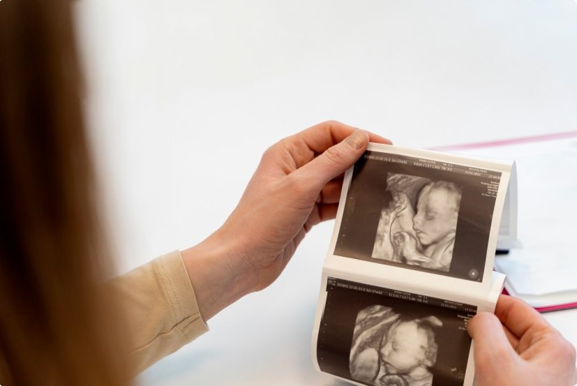 Aborto ou assassinato? Chile pode obrigar mulheres a ouvir coração do feto antes de procedimento